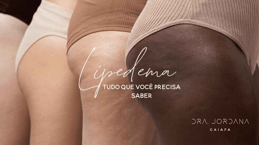 lipedema-blog